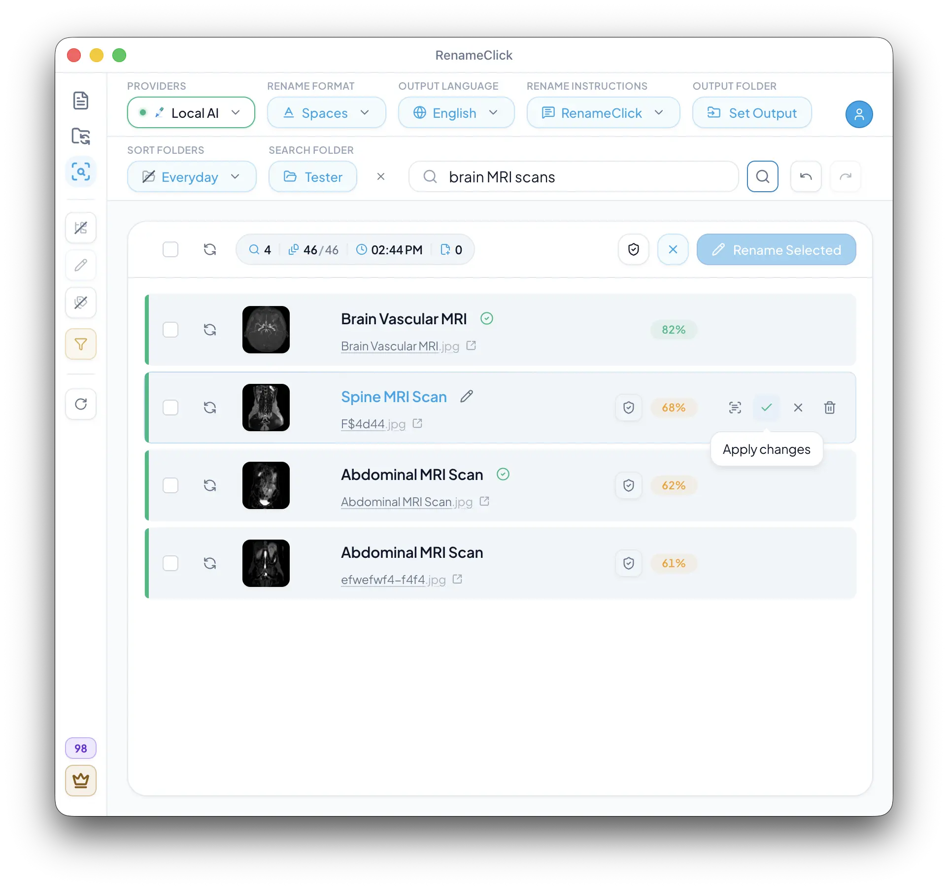 RenameClick AI Search results for a brain MRI query with proposed names, match badges and the Rename Selected button
